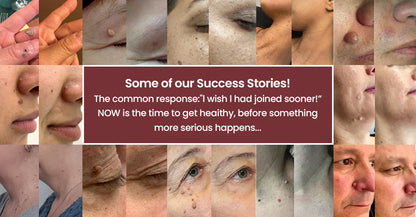 Invisible Patches for Face