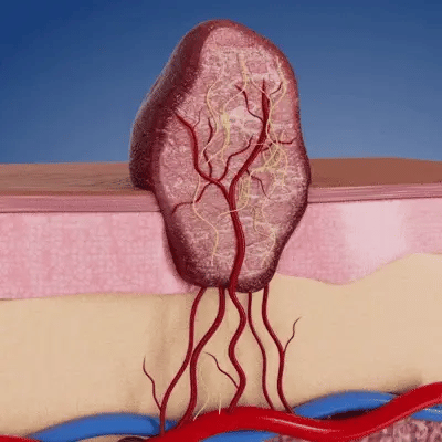 Invisible Patches for Face