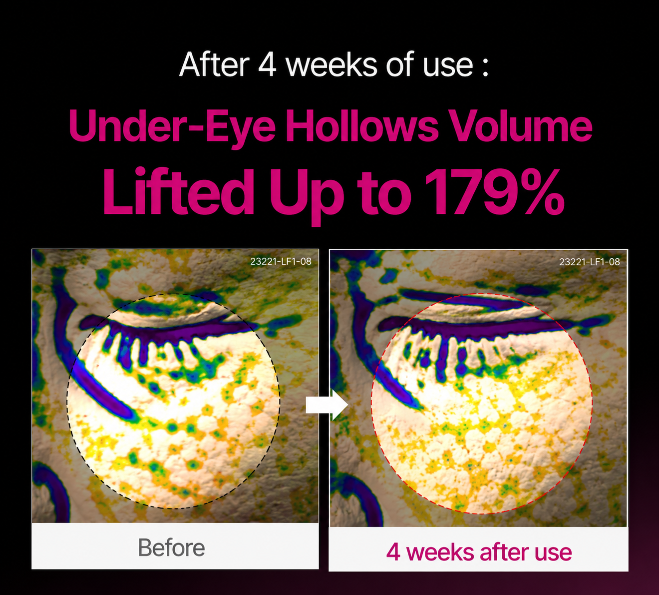 Korean Calcium Dark Spot Eye Cream