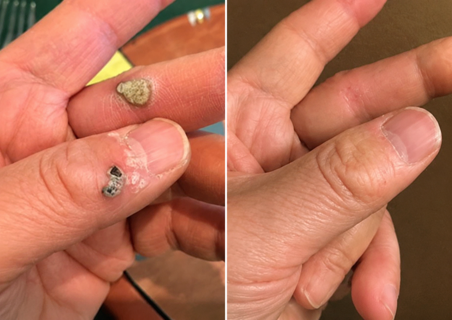 Invisible Patches for Face